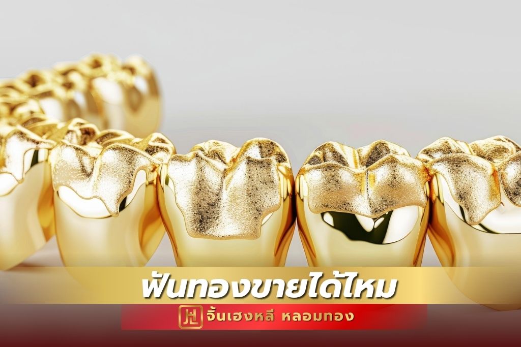 ฟันทองขายได้ไหม